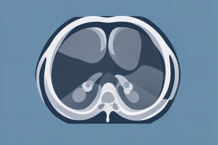 Radiografia de tomografia computadorizada mostrando os seios da face com inflamação e pólipos